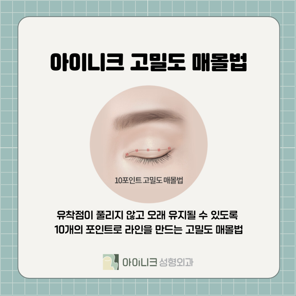 강남눈성형 자연스럽게 하려면 관련 이미지 7