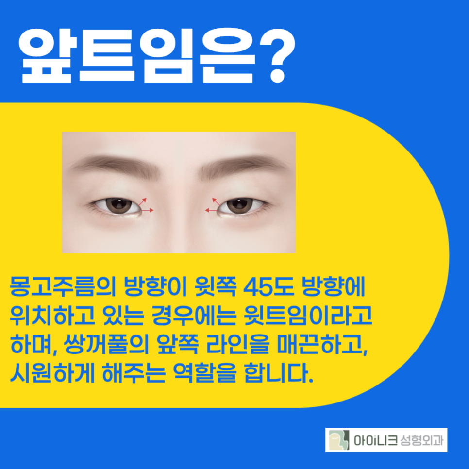 압구정앞트임 실력있는 곳을 원한다면 관련 이미지 3