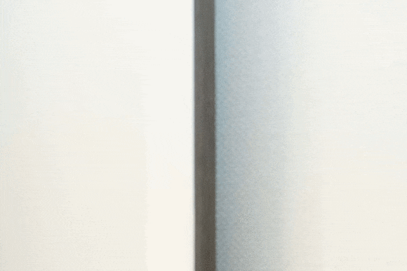 삼성역리프팅, 효과가 가장 좋은 시술은? 관련 이미지 12