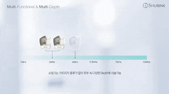 이중턱슈링크, 정말 해결할 수 있을까요? 관련 이미지 6