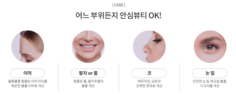 선릉역필러? 밋밋한 얼굴이 고민이라면 읽어주세요 관련 이미지 4