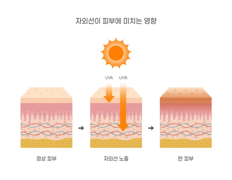 선릉역 점제거 흉터없이 받으려면? <의사의 시술 후기> 관련 이미지 8