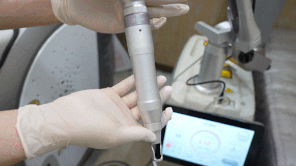 삼성중앙역피부과? 잡티로 고민 중이라면 읽어주세요 관련 이미지 4