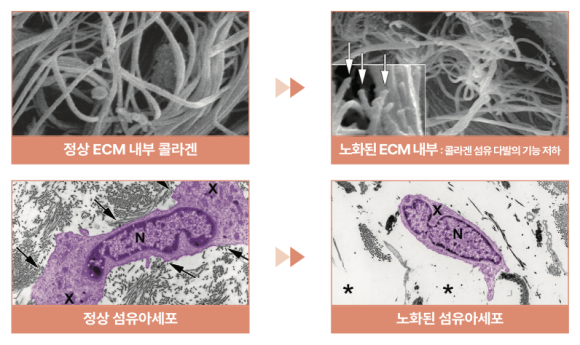 선릉역 스킨부스터? 레티젠 시술을 선호하는 이유 관련 이미지 3