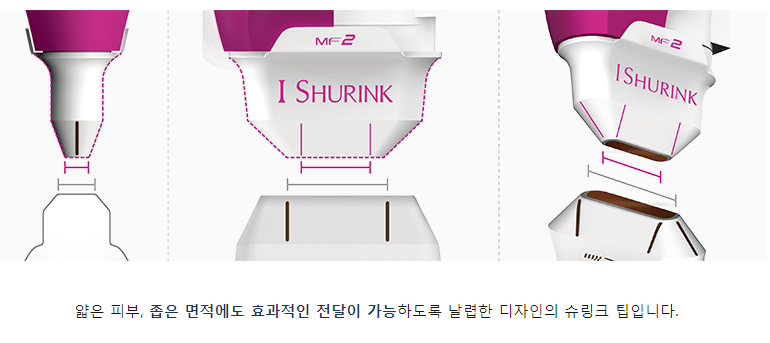 마포슈링크리프팅 웃을때마다 생기는 눈가주름 타임리스로 관련 이미지 3