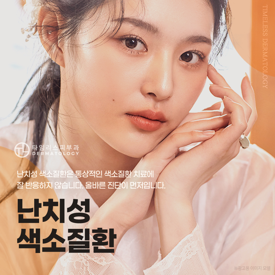 밀크커피반점제거 치료 레이저로 확실하게 관련 이미지 1