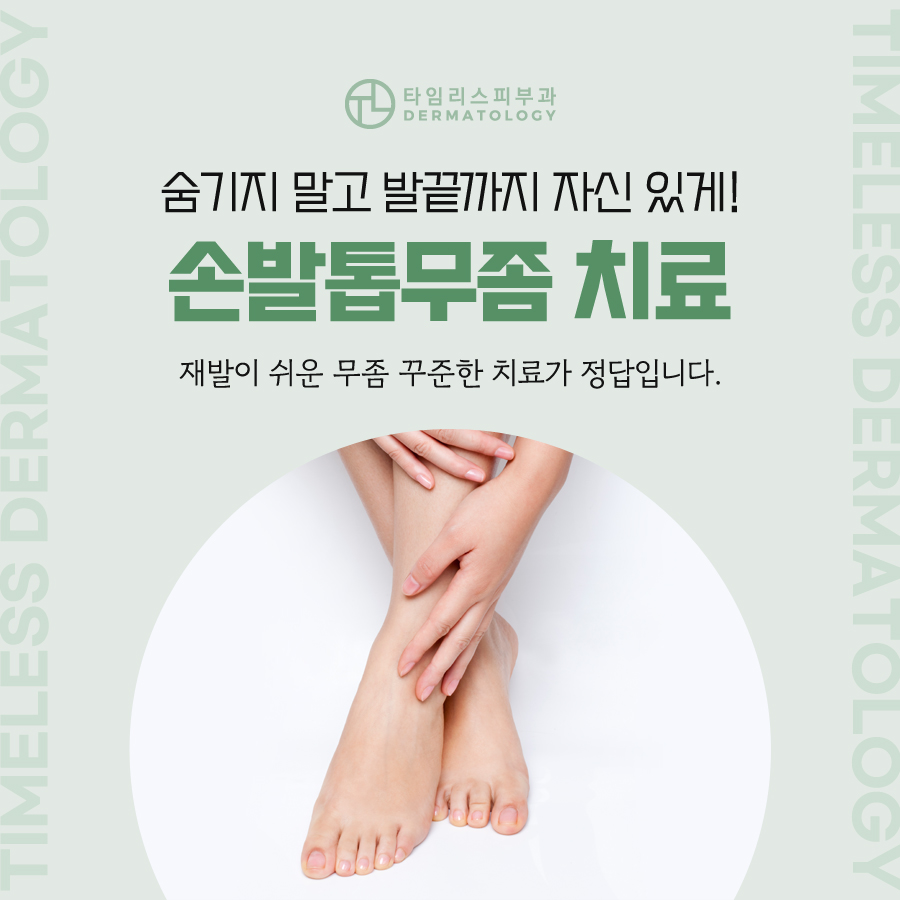 레이저발톱무좀치료 방치하지 말고 관련 이미지 1