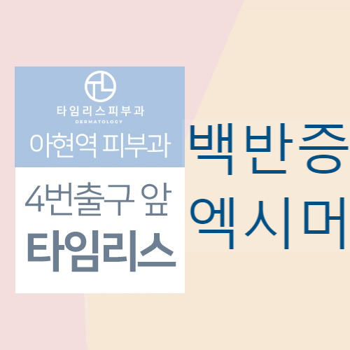 마포구엑시머 백반증 초기증상 보일때 치료받으세요 관련 이미지 1