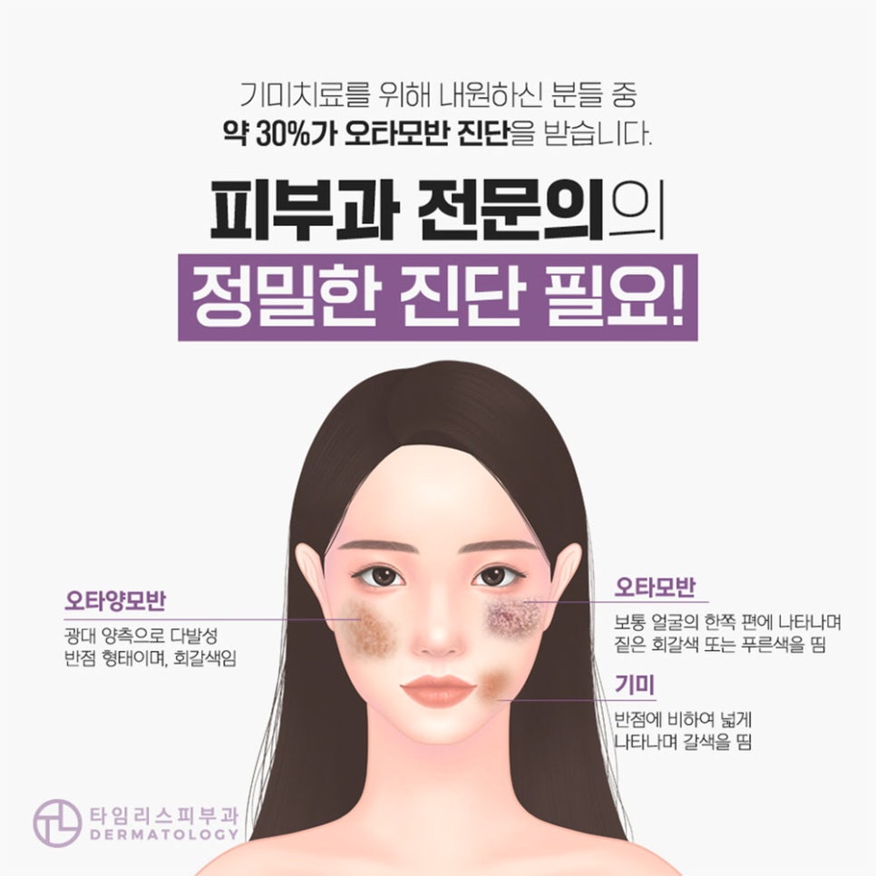 마포피부과 색소침착 적절한 시기에 치료를! 관련 이미지 2