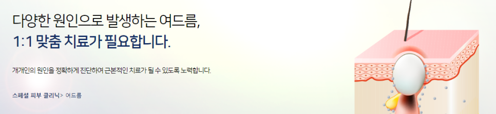 마포여드름치료 타임리스에서 1:1 맞춤으로 관련 이미지 2