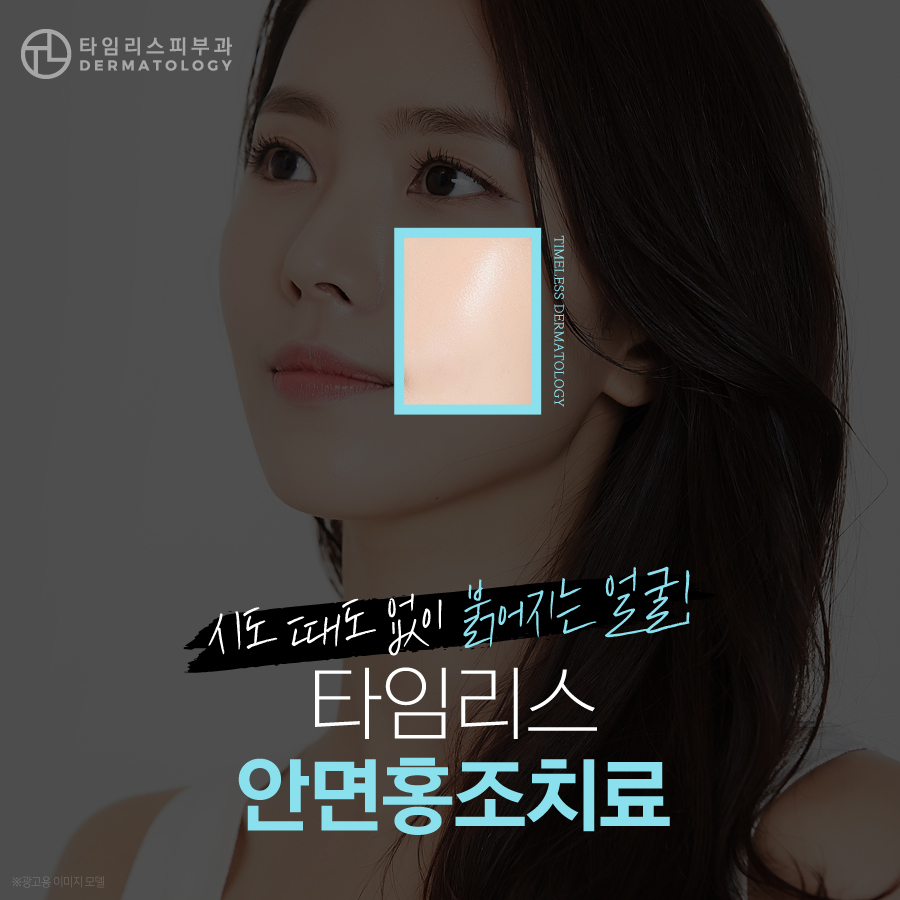 얼굴 안면홍조피부과 붉은 색소만 선택적으로 관련 이미지 1