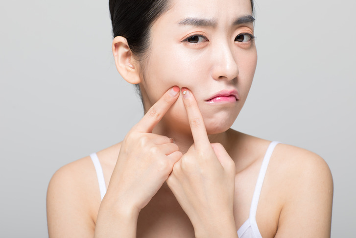 여드름관리 흉터까지 관리할 수 있을까? 관련 이미지 1