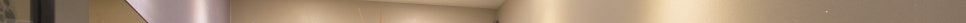 마포티타늄리프팅 수술 없이 빠르게 변화하는 얼굴 라인 관련 이미지 19