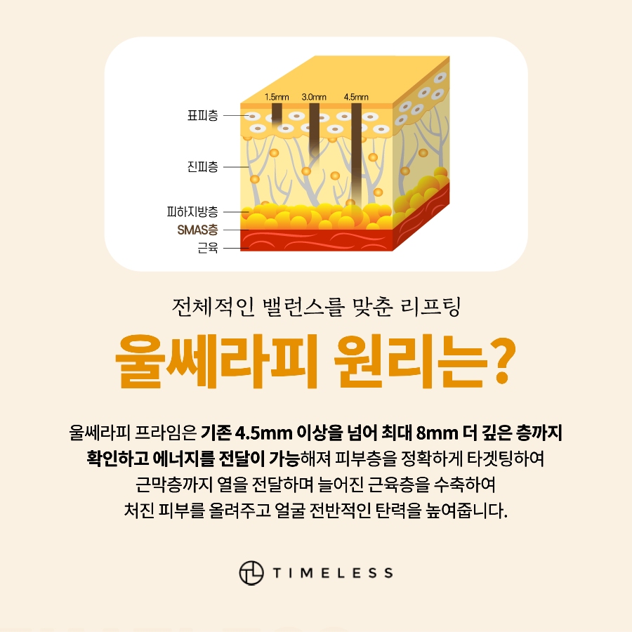 서대문구리프팅 울쎄라피프라임으로 탄력있게 관련 이미지 3