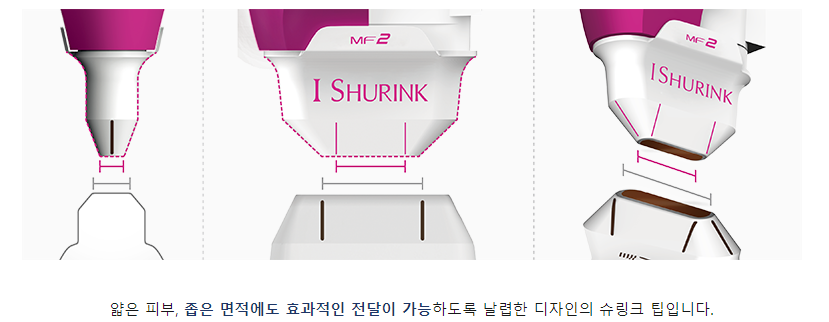 이대피부과 이중턱 타임리스 골드슈링크리프팅으로 당기기 관련 이미지 4