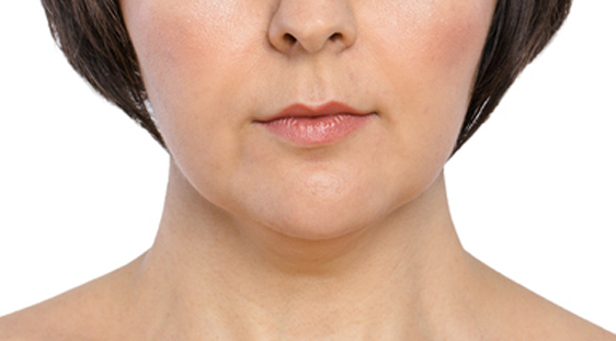아현역보톡스 잘하는곳 타임리스에서! 관련 이미지 2