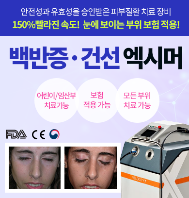 마포/아현 엑시머 백반증과 건선 치료해요 관련 이미지 5