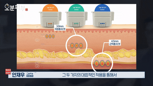 Seodaemun Station Dermatology Clinic Ultherapy Lifting? This Article Settles the Questions About Results and Shot Counts image 7