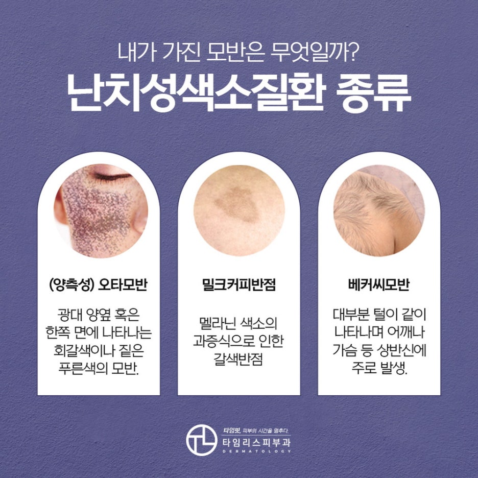 오타양모반치료 얼룩졌던 피부와 이별을 관련 이미지 3