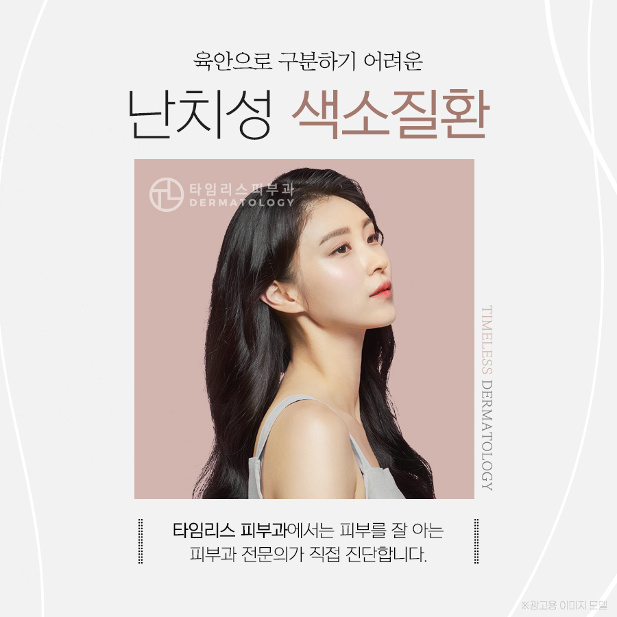 마포레이저 밀크 커피색반점 치료를 위해 관련 이미지 1
