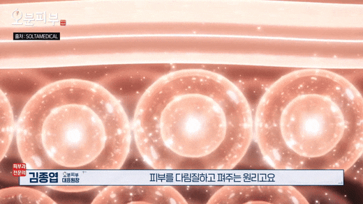 Written by a Dermatology Specialist in Seodaemun-gu: Ultherapy vs. Thermage Effects <Complete Summary> image 5