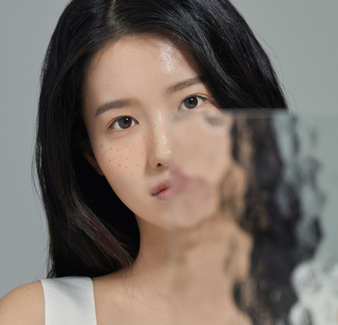 마포피부과 기미주근깨레이저 맨얼굴도 자신있게 관련 이미지 2