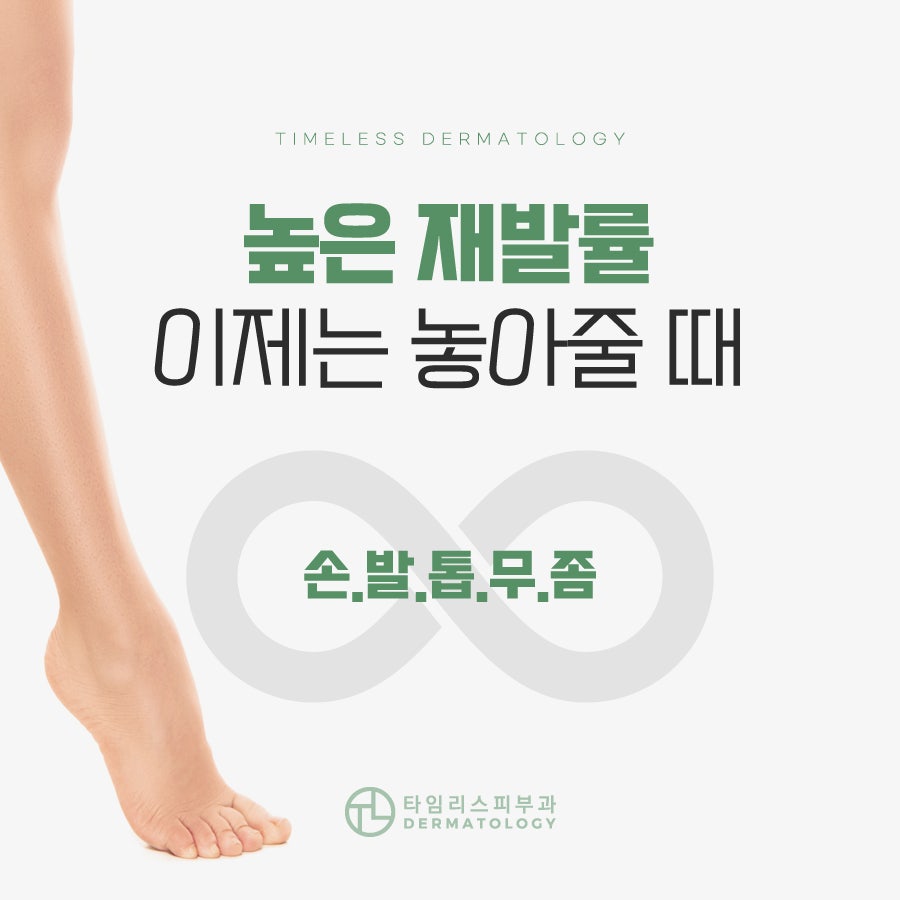 홍대손발톱무좀 쉽게 사라지지 않는다면 관련 이미지 2