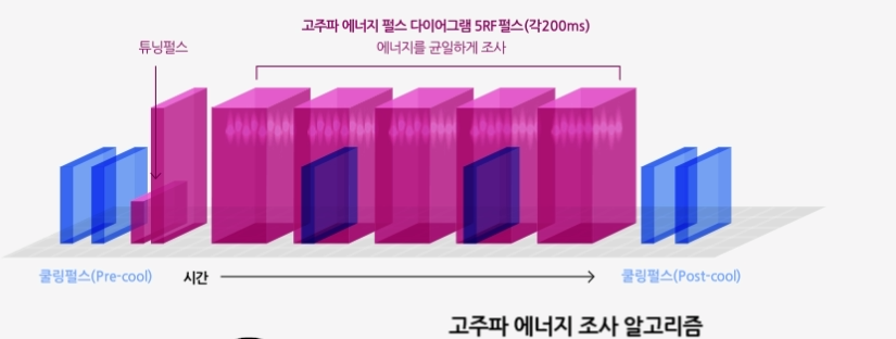 합정써마지 피부 탄력이 무너져 보이기 시작했다면 관련 이미지 3