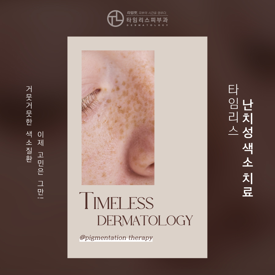 난치성색소질환 기미와 다른점은? 관련 이미지 1