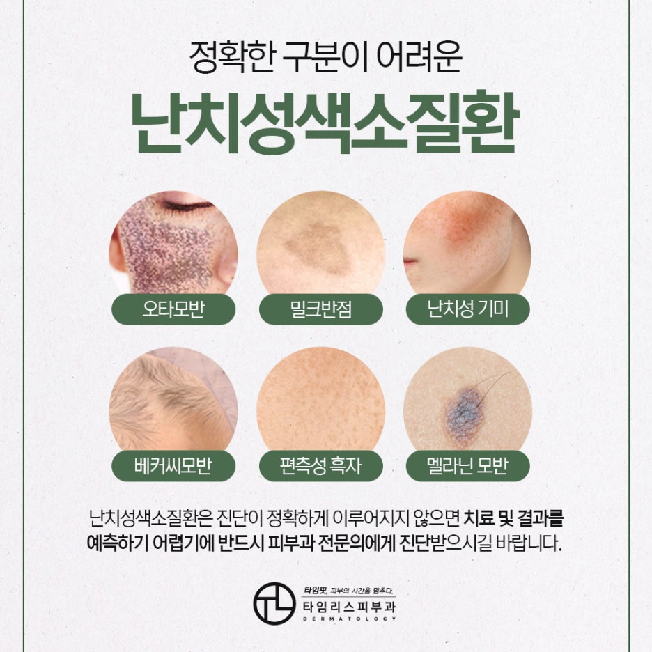 공덕동피부과 어떤 반점이라도 말끔하게 관련 이미지 2