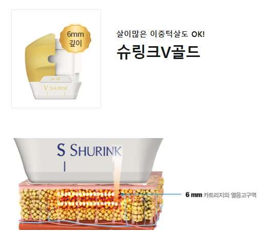 아현역피부과 슈링크리프팅효과 날렵한 턱선 관련 이미지 6