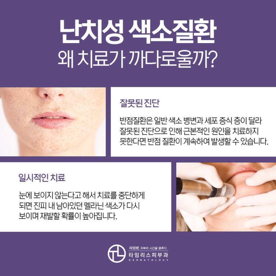 마포역피부과 까다로운 난치성 모반도 깔끔하게 관련 이미지 3