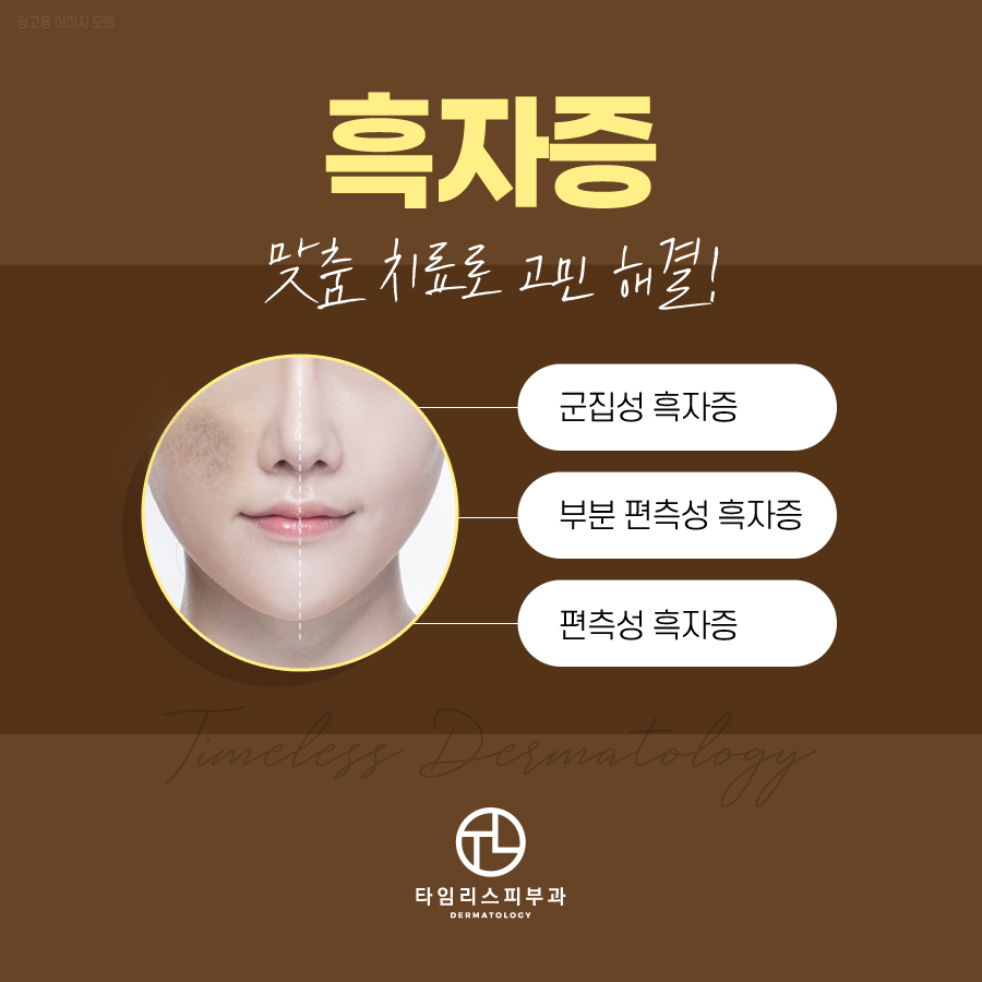 마포피부과 잘하는곳 반점이 있다면? 관련 이미지 5