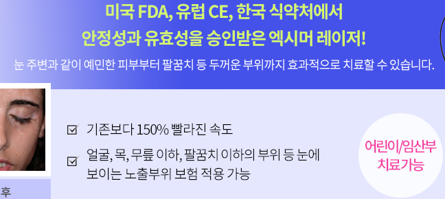 피부건선원인 은백색 각질 가려움증 왜 생기는걸까 관련 이미지 7