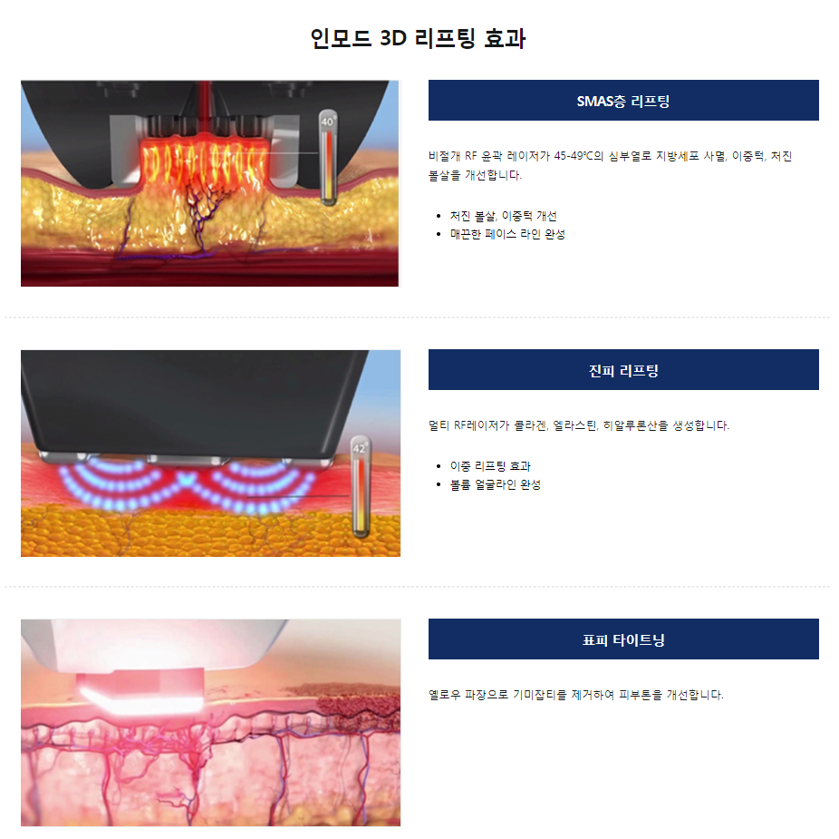 아현역리프팅잘하는곳 이중턱 처진볼살 타임리스 인모드로 관련 이미지 5