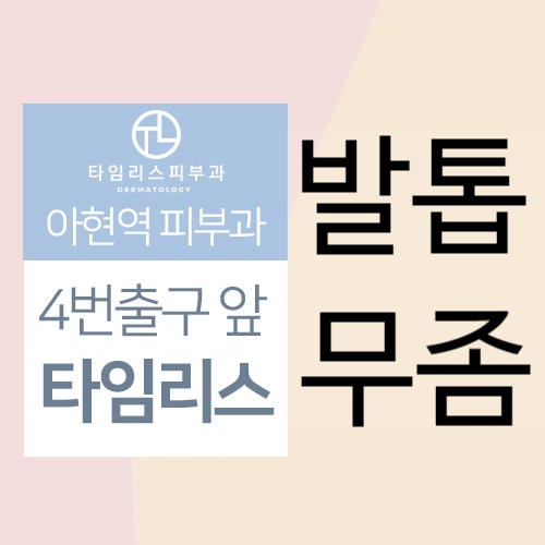 마포무좀치료 가려운발 참지말고 타임리스로오세요 관련 이미지 1