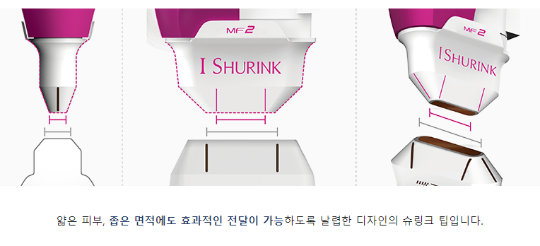 아현역피부과 얼굴주름 리프팅 골드슈링크리프팅 타임리스 관련 이미지 5