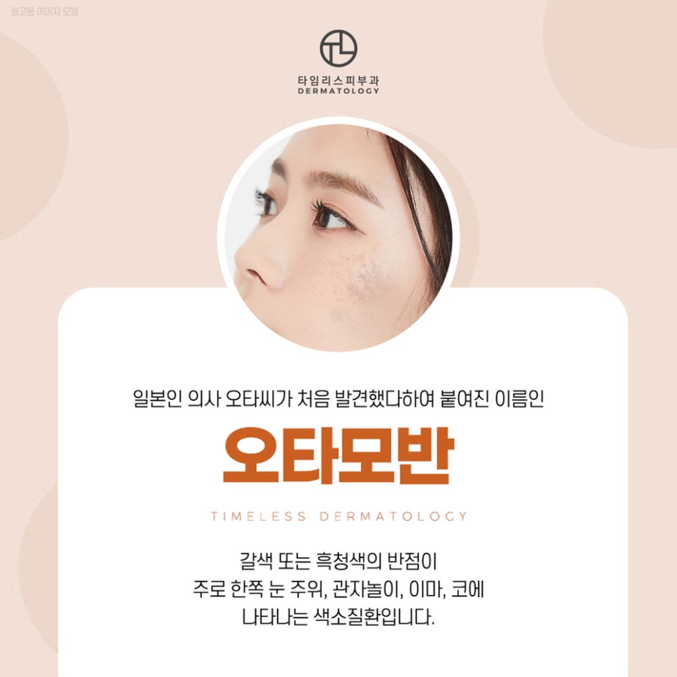 피부반점으로 상처받는 일은 이제 그만! 관련 이미지 4