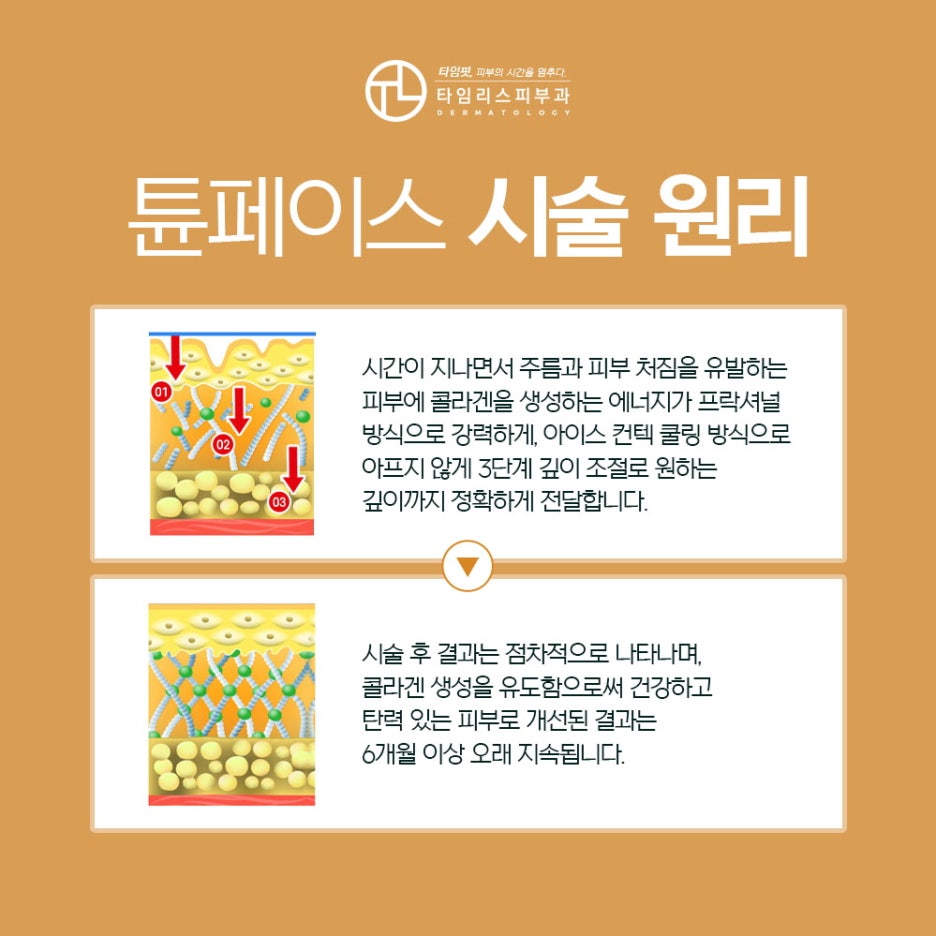 신촌역피부과 기존 고주파 이상의 효과를 관련 이미지 3