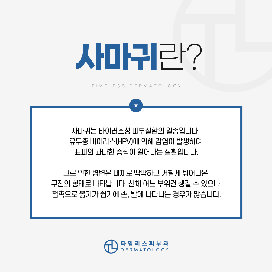 마포사마귀 레이저 치료 가능할까 관련 이미지 3