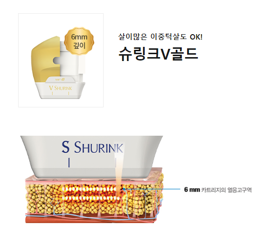 아현역피부과 얼굴주름 리프팅 골드슈링크리프팅 타임리스 관련 이미지 4