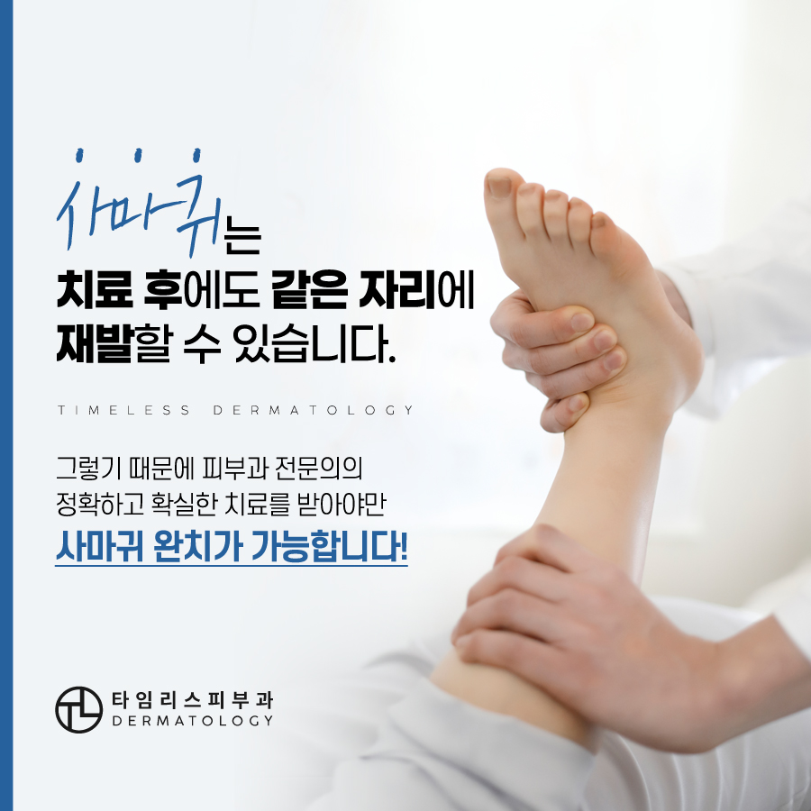 마포사마귀 레이저 치료 가능할까 관련 이미지 7