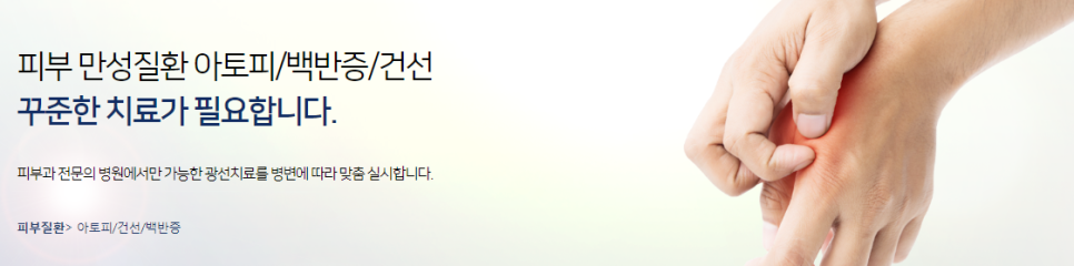 공덕아토피피부과 타임리스에서 아토피치료 관련 이미지 3