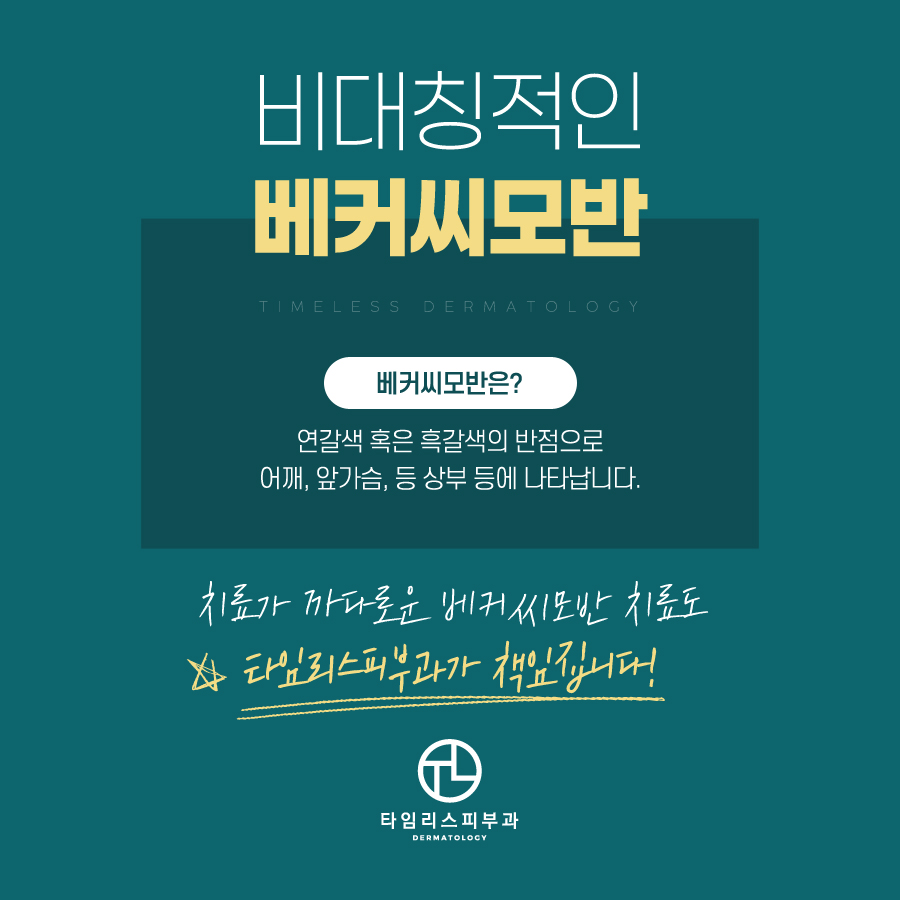 베커씨모반치료 고민은 그만! 관련 이미지 2