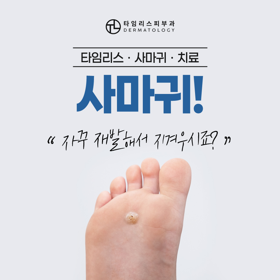 마포사마귀치료 빠르면 빠를수록 관련 이미지 1