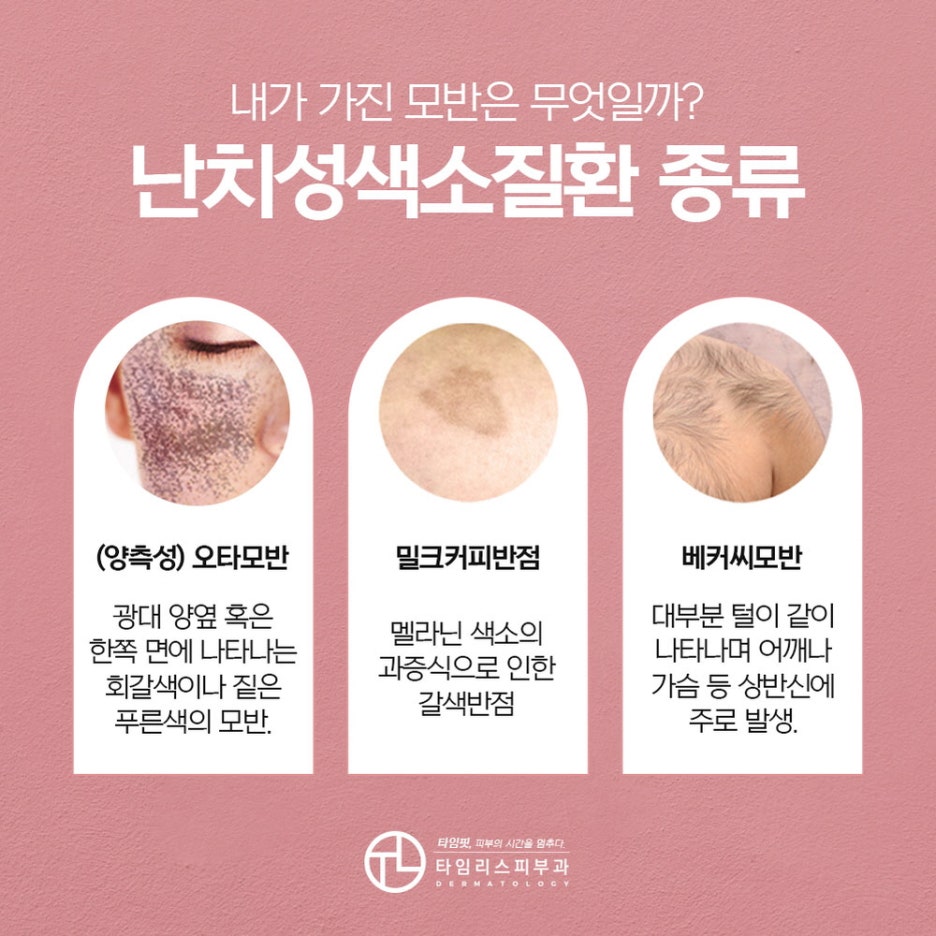 북아현동피부과 어떠한 모반이든 깔끔하게! 관련 이미지 3