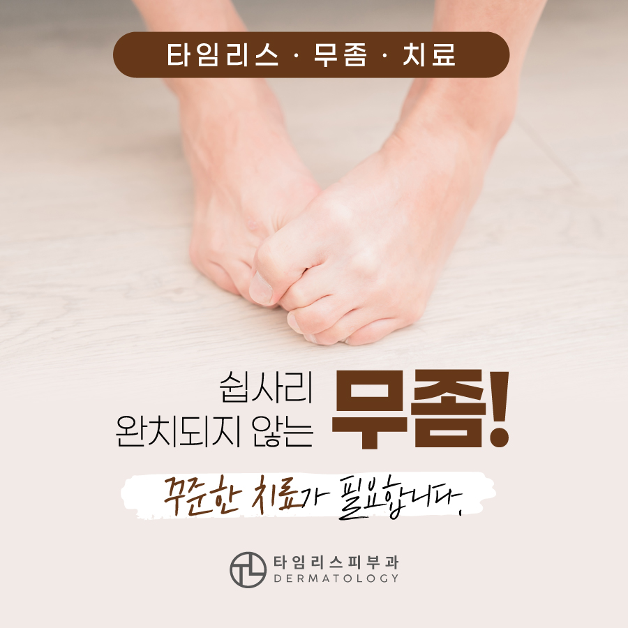 손발톱무좀 치료는 타임리스피부과! 관련 이미지 2