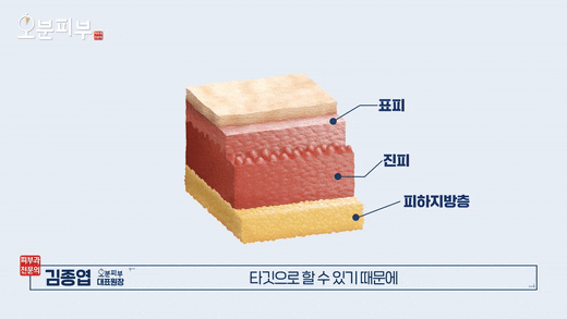 Ahyeon Dermatology Clinic Sofwave, Before the Procedure image 3