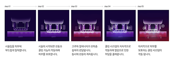 Why Are Thermage and Sofwave Discussed Together at Gongdeok Station Dermatology? image 2