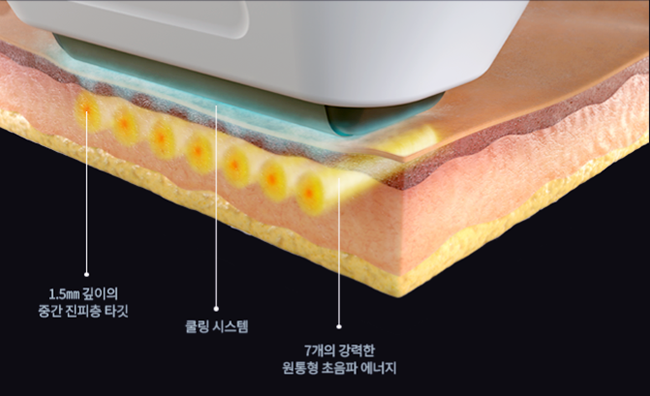 공덕에서 소프웨이브 리프팅을 고민한다면 꼭 알아야 할 포인트 관련 이미지 2